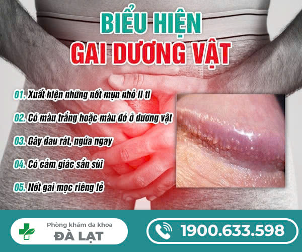 Hình ảnh minh họa